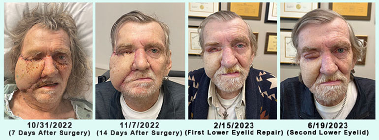 Surgery Progression